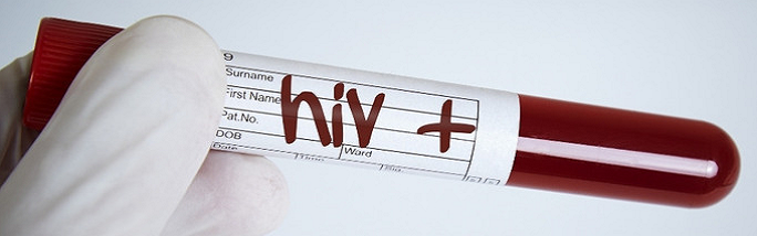 hiv