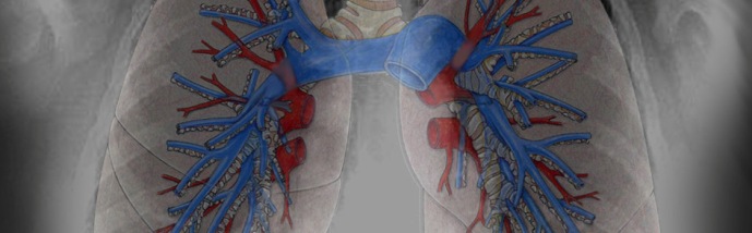 radiografia polmonare